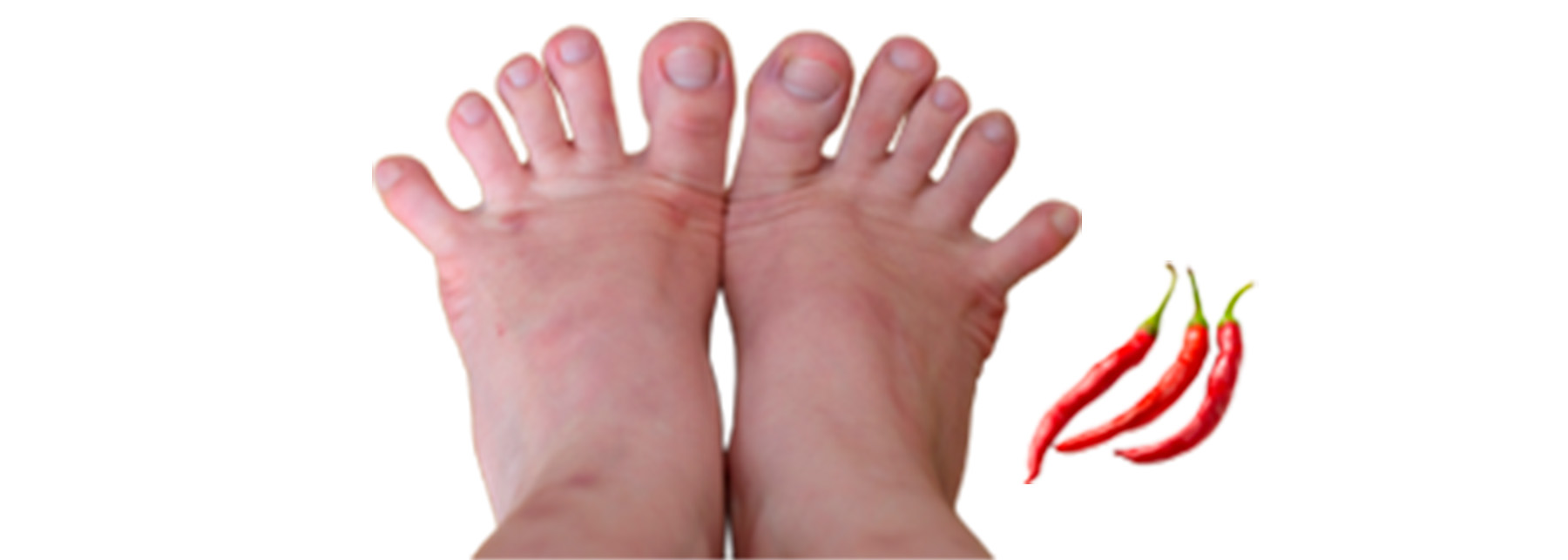 食育まめ知識「しもやけには唐辛子がいいって本当？」